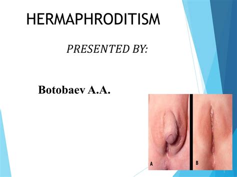 hermaphroditism-2,causes,treatment,drugs.pptx