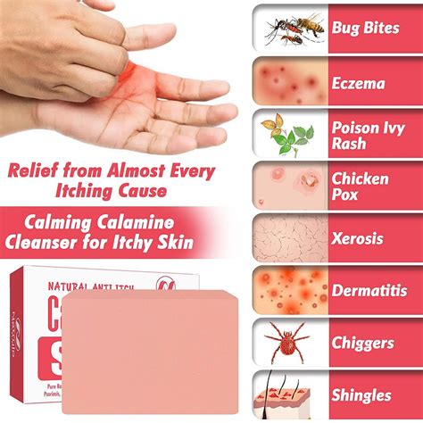 Natural Calamine Soap Bar for Instant Itch Relief - 4 Ounce Anti-Itch Defense for Bug Bites ...