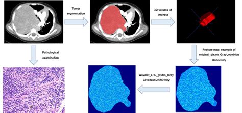 Image result for Tumor Segmentation Using Python