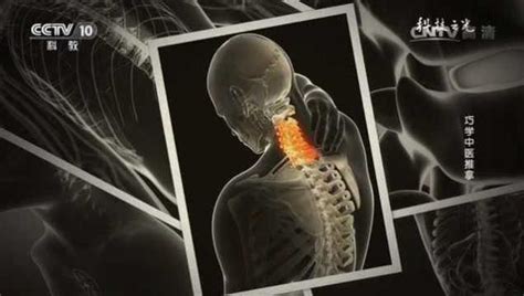 中医推拿 缓解颈椎病 腰椎病 带来的疼痛_腾讯视频