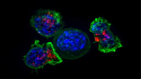 Identifying therapeutic targets by peeking inside the bladder cancer ...