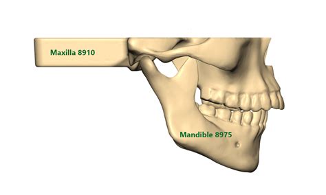 Mandible Vs Maxilla