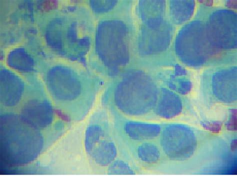 Image result for Diff Quick Stain