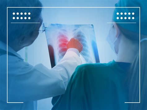 Lung cancer ICD 10 - ICD 10 Lung Cancer
