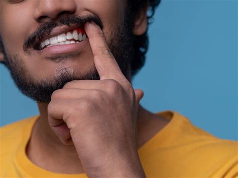 Don't Ignore Gum Diseases! It Could Increase The Risk Of These Health ...