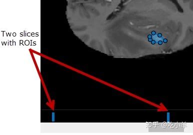 Image result for Volume Segmenter MATLAB Tutorial