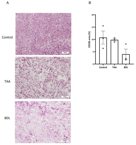 Optimization of Statin-Loaded Delivery Nanoparticles for Treating ...
