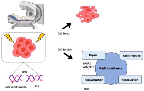 External Beam Radiation Therapy Treatment Planning For Clinically Localized Prostate Cancer ...