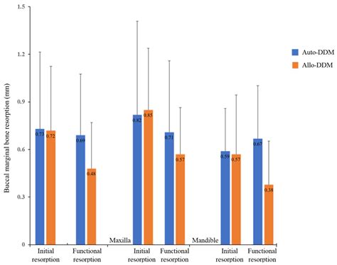 Allogeneic Demineralized Dentin Matrix Graft for Guided Bone ...