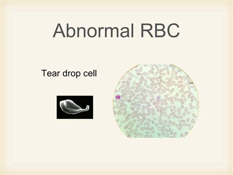 Blood smear morphology | PPTX