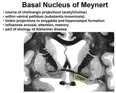 EXAMS AND ME : Basal Nucleus Of Meynert