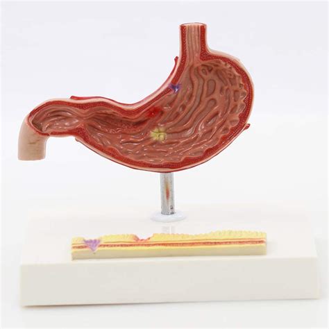 Buy Anatomical Model Of Life-Sized Stomach - Anatomical Model Of The ...