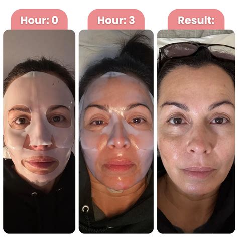Bio-Collagen Mask – quasi