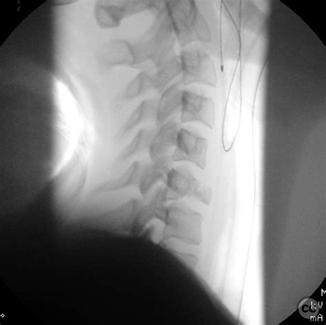 Image result for Python Google Cpde