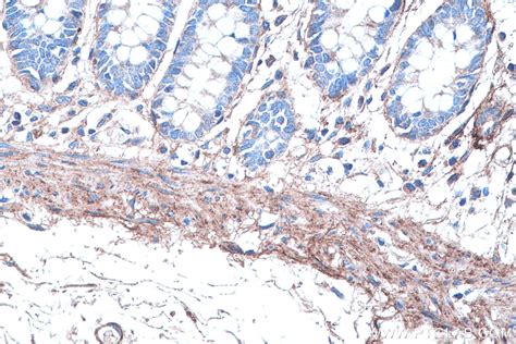 IHCeasy COL6A2 Ready-To-Use IHC Kit KHC0315 | Proteintech