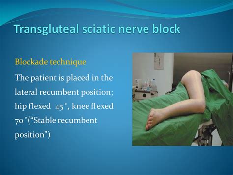 PPT - Peripheral Nerve Blocks using Nerve Stimulator PowerPoint ...
