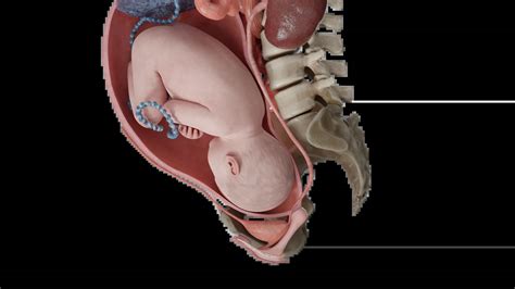 3D Model of Left Occiput Anterior Position