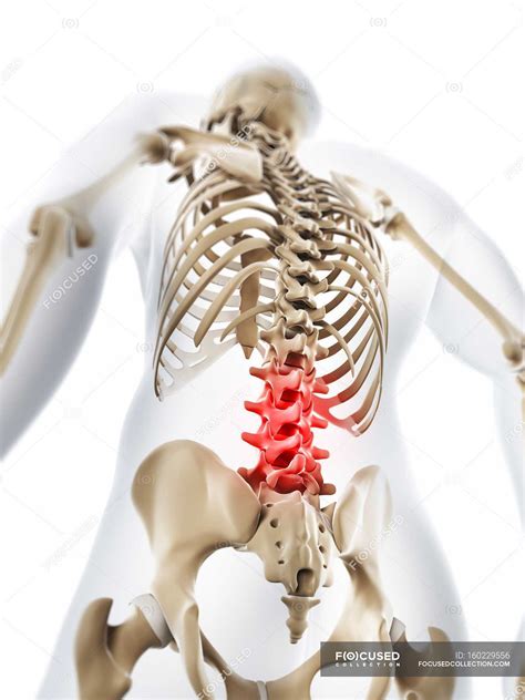 Huesos de cadera - Fotos de stock, imágenes sin royalties | Focused