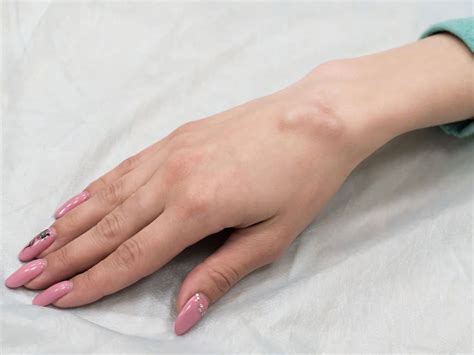 Cyst at Home Burst 的图像结果