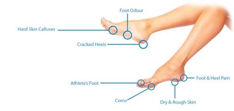 Tips About Healthy Feet Management and Repair
