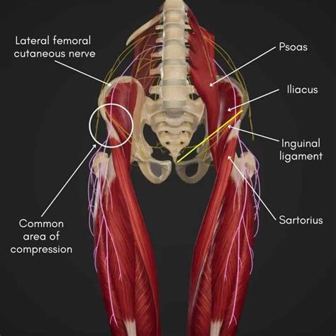 Psoas Making Leg Numb