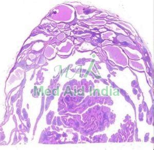 Saliivary Gland Lesions Digital Slides Set Manufacturer, Supplier from ...