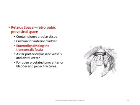 Urinary Bladder anatomy 1 | PDF