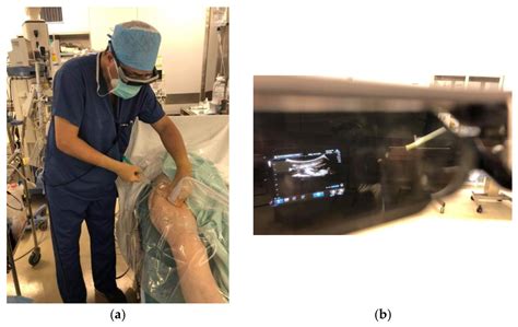 Physical Ergonomics in Peripheral Nerve Block