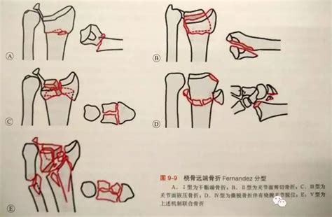 吴孟达遗产分配情况曝光：现任太太子女分的多_凤凰网视频_凤凰网