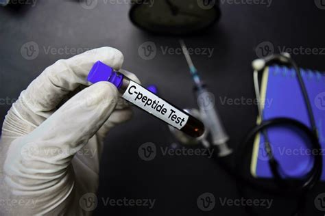 C-peptide Test text with blood sample. Top view isolated on black ...