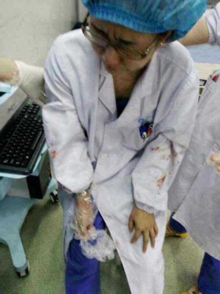 女医生参与抢救后被患者丈夫殴打视力听力下降|医患冲突_新浪新闻