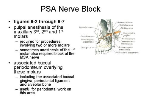 Local Infiltration Anesthesia 的图像结果
