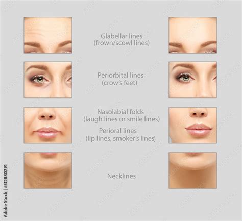 Aging Sign 的图像结果