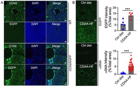 Production, Exacerbating Effect, and EV-Mediated Transcription of ...