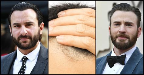 6 Major Things Every Man Should Know When They Start To Experience Hair ...