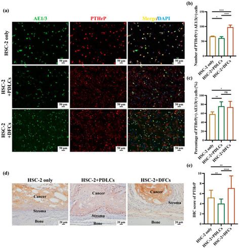 Impacts of Dental Follicle Cells and Periodontal Ligament Cells on the ...