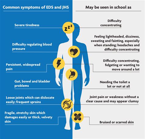 Ehlers-Danlos Syndrome (Eds) Hypermobility Type at Lucinda Nicoll blog