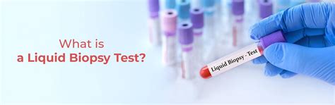 Liquid Biopsy: A Simple Blood Test For Early Cancer Detection