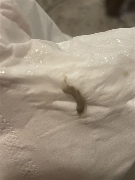 Coughing up black stuff : r/DiagnoseMe