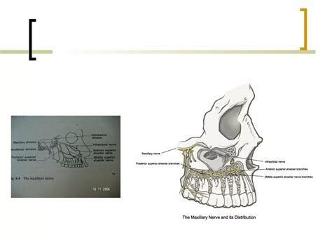 Local Anesthesia Injection 的图像结果