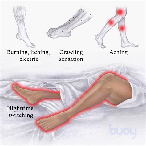 Exercises for Restless Legs Syndrome: 10 Ways to Find Relief