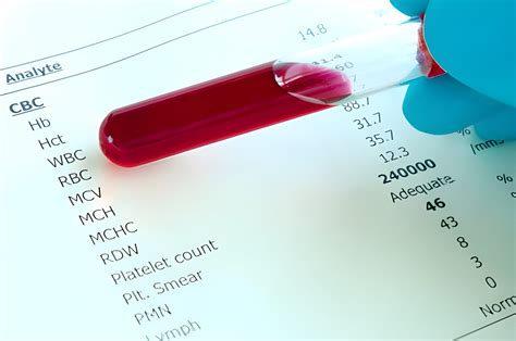 High MCV and MCH Count in Blood Tests: 5 Causes and What They Mean for ...