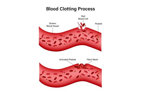 Process of Blood Clotting 的图像结果