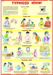 Typhoid Chart Photographic Paper - Educational posters in India - Buy ...