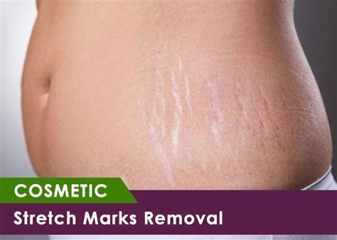 Skin Heights Clinic