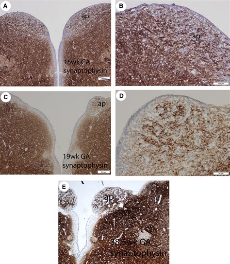 Area Postrema: Fetal Maturation, Tumors, Vomiting Center, Growth, Role in Neuromyelitis Optica ...