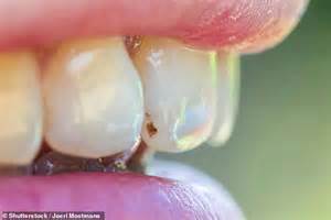 What the colour of your TEETH says about you, according to science