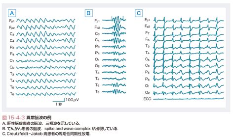 Image result for Machine Learning Multiple Layer