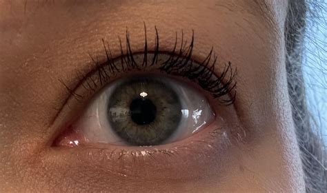 Swollen/red inner corner of my eye : r/Dryeyes