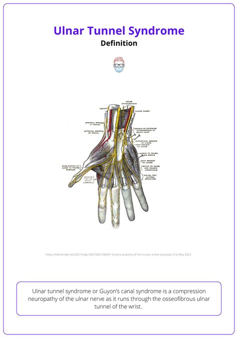 Ulnar Tunnel Syndrome: Anatomy, Clinical Features, & Management